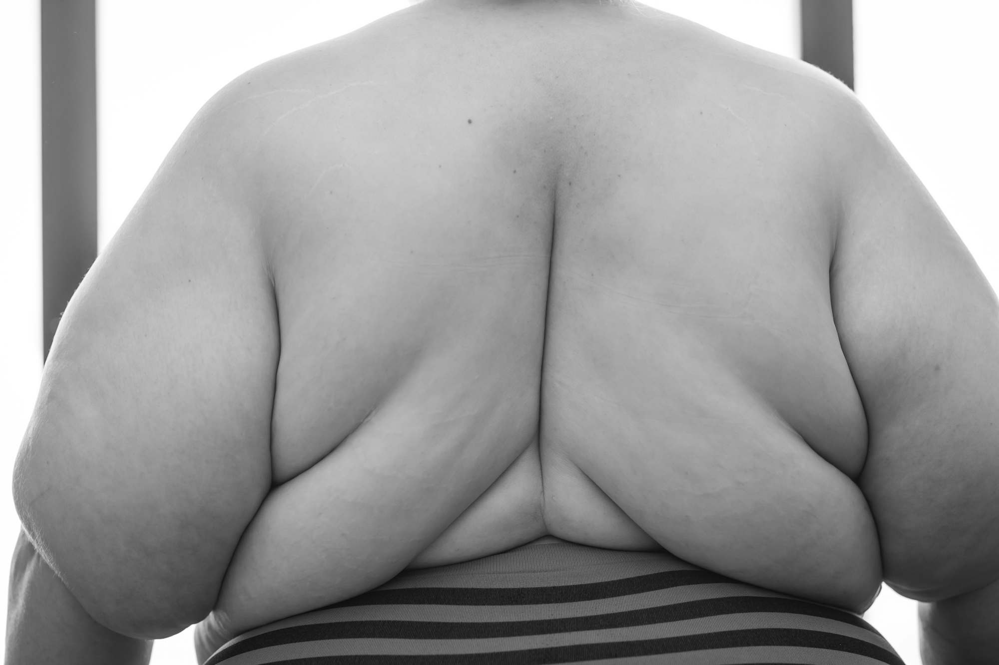A fat person's back folds are displayed prominently in a fat positive photo shoot