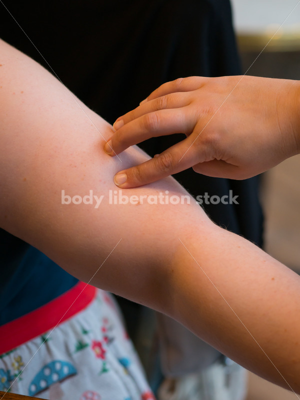 Stock Photo: Acupuncture Student Palpates to Locate Large Intestine Acupuncture Points - Body Liberation Photos