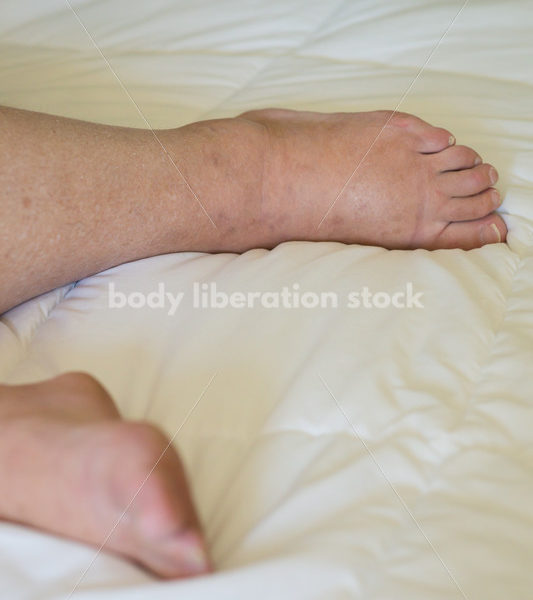 Eating Disorder Recovery Body Image Stock Photo: Close-Up View of Recovering Woman - Body Liberation Photos