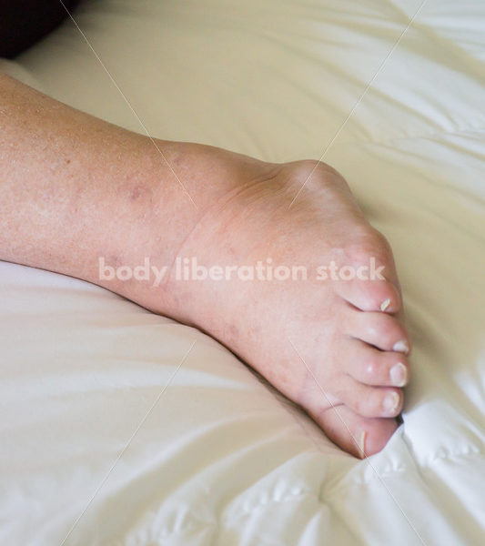 Eating Disorder Recovery Body Image Stock Photo: Close-Up View of Recovering Woman - Body Liberation Photos