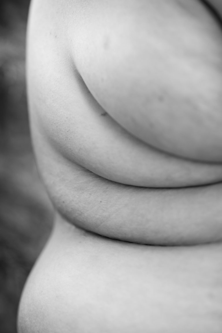 A fat woman's shoulder, side rolls and hip are shown in a black-and-white photograph.