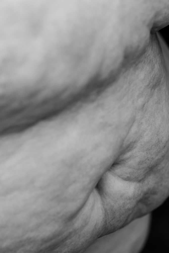 Image description: The belly of a fat body is shown in a black-and-white photograph, with highly textured skin.