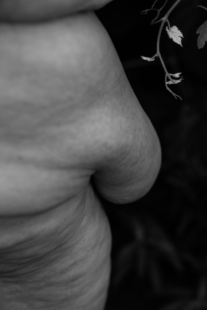 Image description: The belly roll of a fat body is shown in a black-and-white photograph, with highly textured skin.