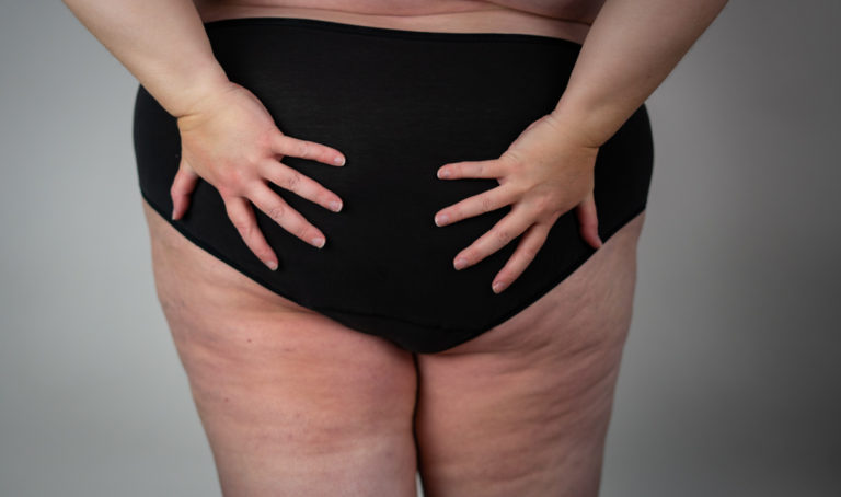 A fat white woman stands facing away from the camera, wearing black panties, with her hands spread over her butt.