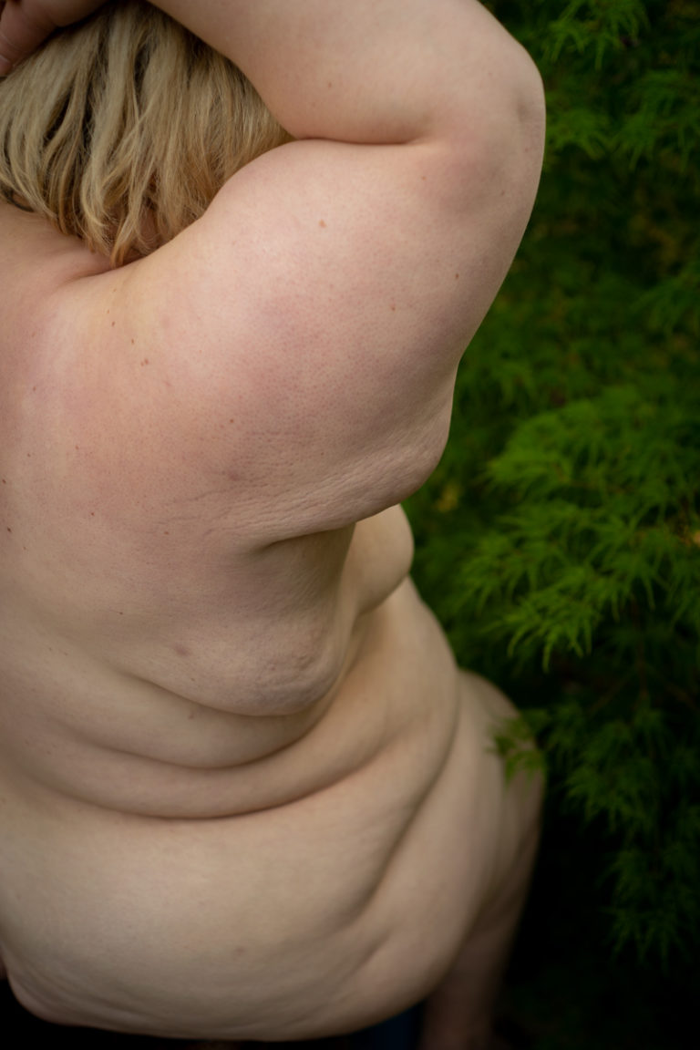 A fat white woman's side rolls and skin texture are shown as she sits among green leaves.