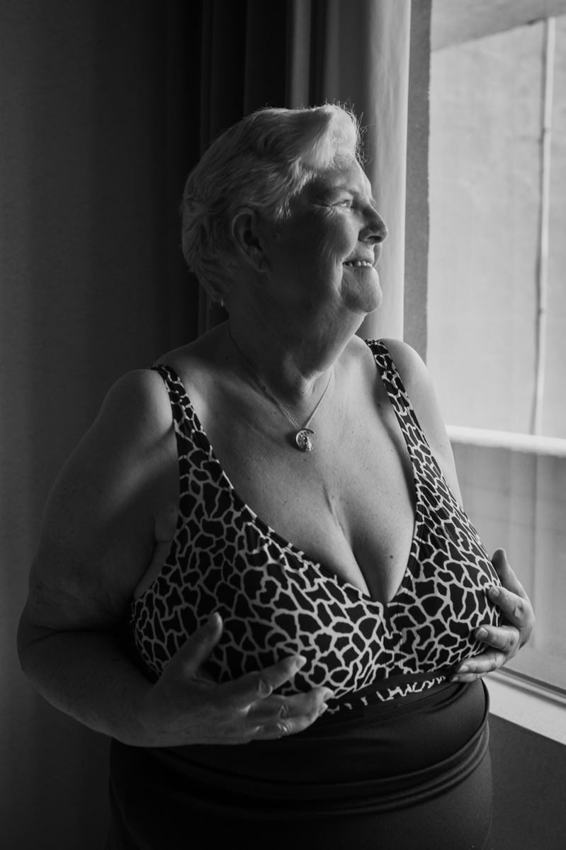 An older woman touches her chest in a black-and-white photo. She's wearing a bra and necklace, and has a visible surgery scar on her chest.
