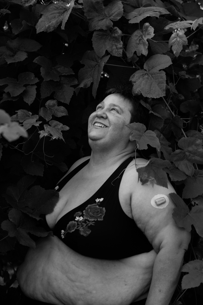 A superfat woman with a continuous glucose monitor and a bikini smiling at a representation stock photo shoot in a garden.